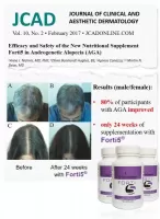 Forti5® - добавка за попомагане растежа на косата